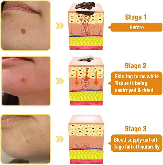 Bee Venom Skin Treatment Cream,Repair Maximum Strength for All Skin Types (2PCS)